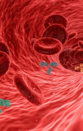 coronary artery disease